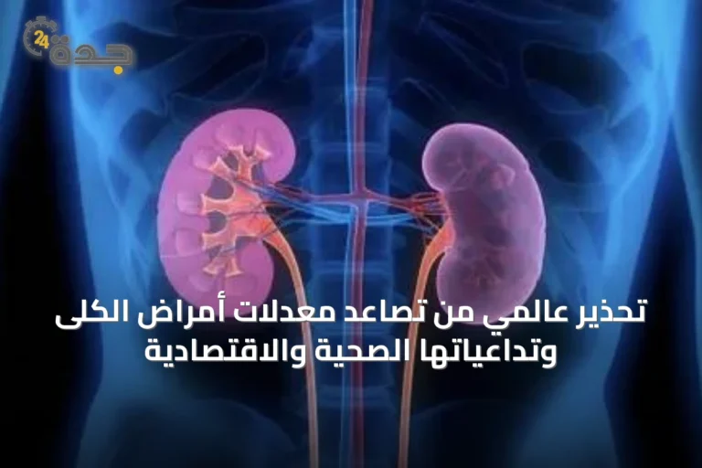 تحذير عالمي من تصاعد معدلات أمراض الكلى وتداعياتها الصحية والاقتصادية