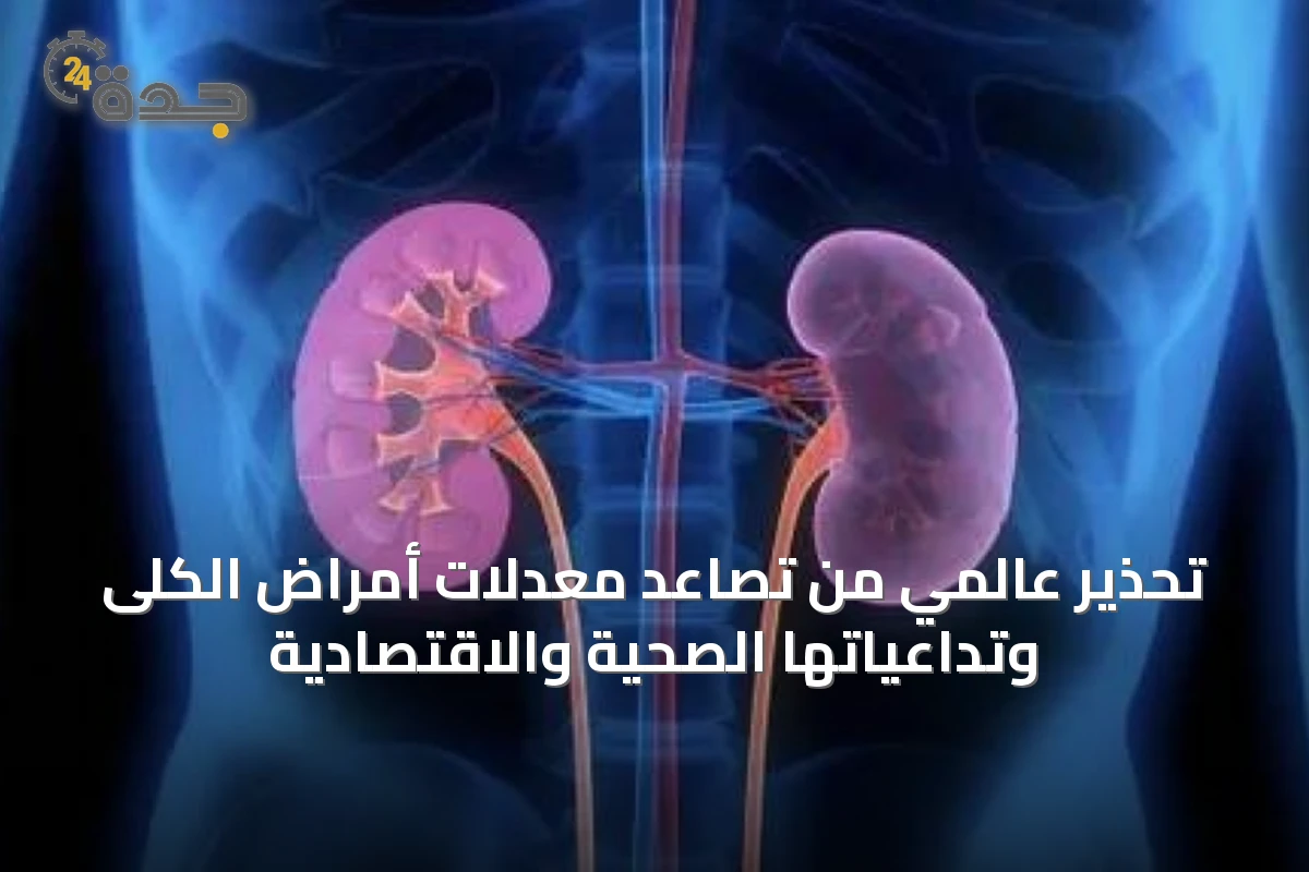 تحذير عالمي من تصاعد معدلات أمراض الكلى وتداعياتها الصحية والاقتصادية