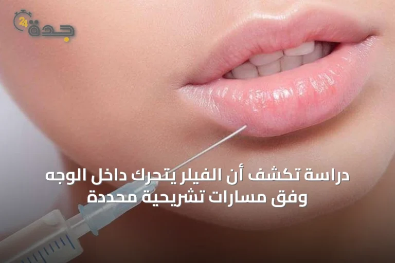 دراسة تكشف أن الفيلر يتحرك داخل الوجه وفق مسارات تشريحية محددة