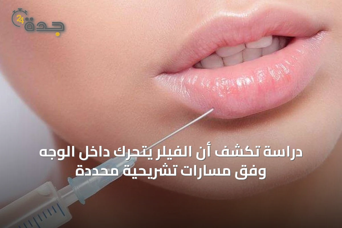 دراسة تكشف أن الفيلر يتحرك داخل الوجه وفق مسارات تشريحية محددة