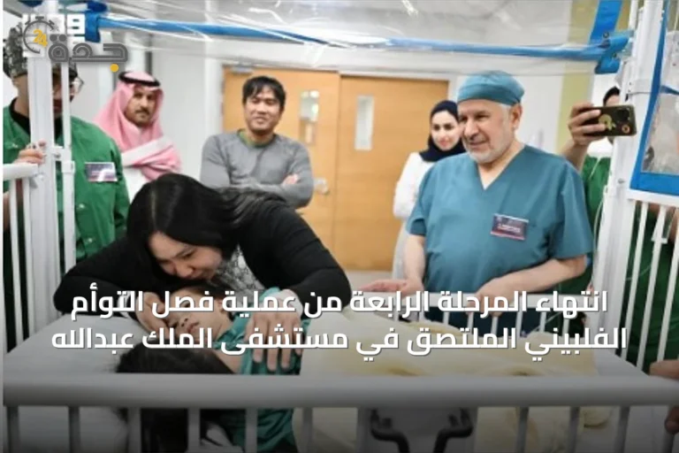 انتهاء المرحلة الرابعة من عملية فصل التوأم الفلبيني الملتصق في مستشفى الملك عبدالله