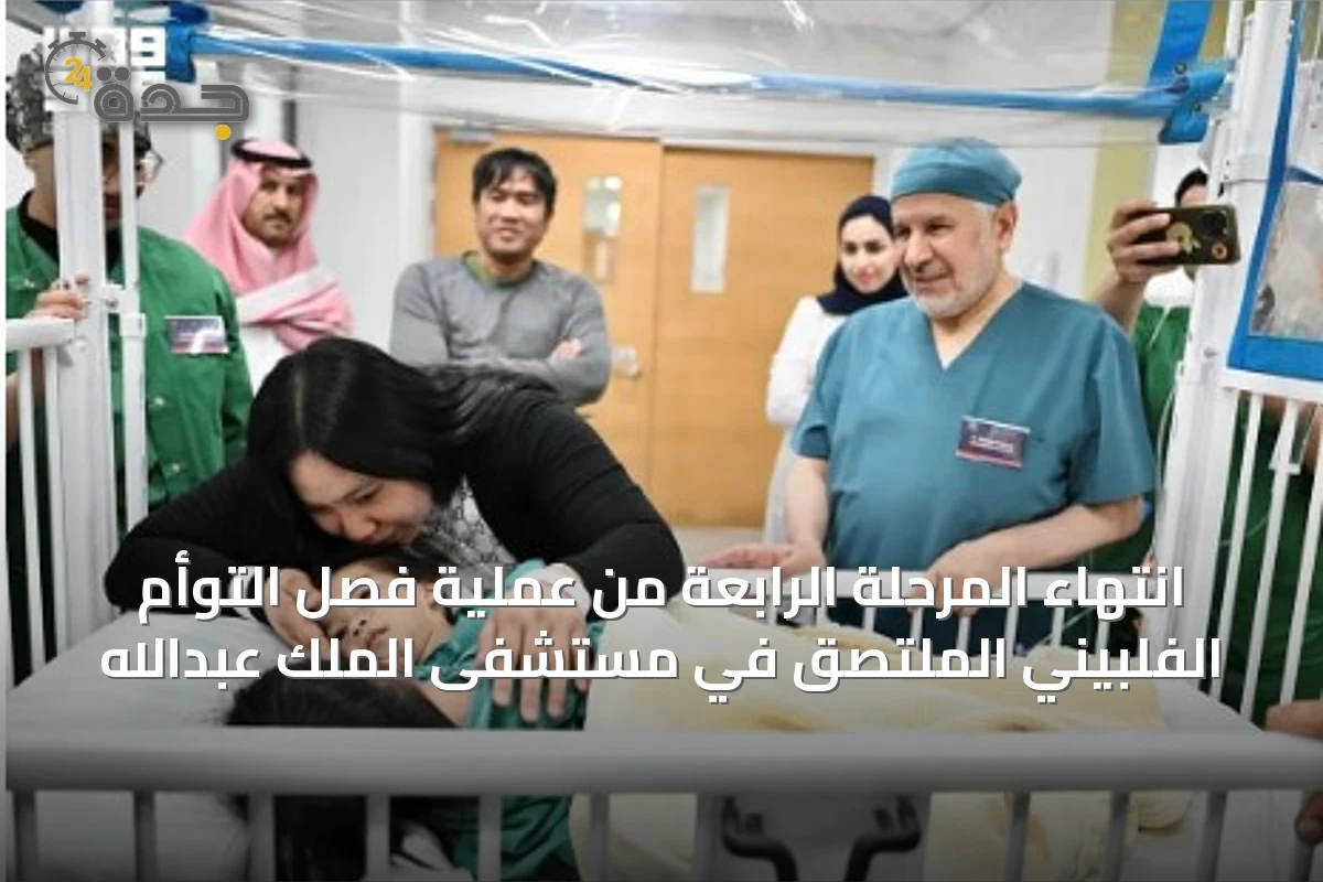 انتهاء المرحلة الرابعة من عملية فصل التوأم الفلبيني الملتصق في مستشفى الملك عبدالله