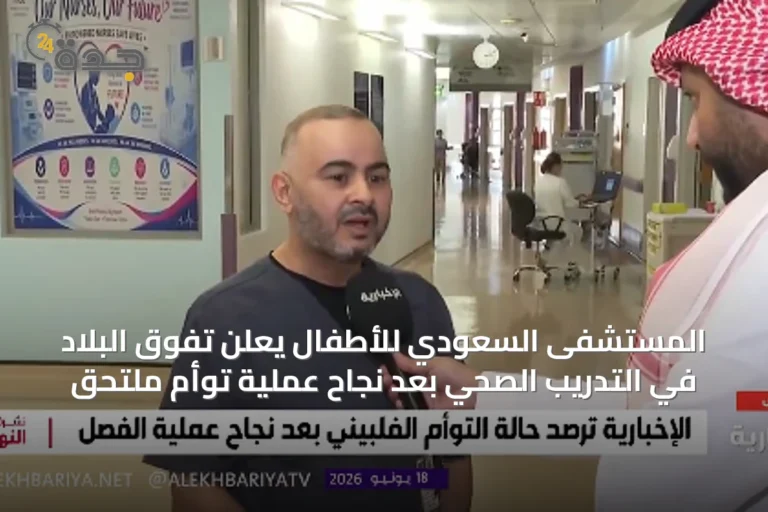 المستشفى السعودي للأطفال يعلن تفوق البلاد في التدريب الصحي بعد نجاح عملية توأم ملتحق