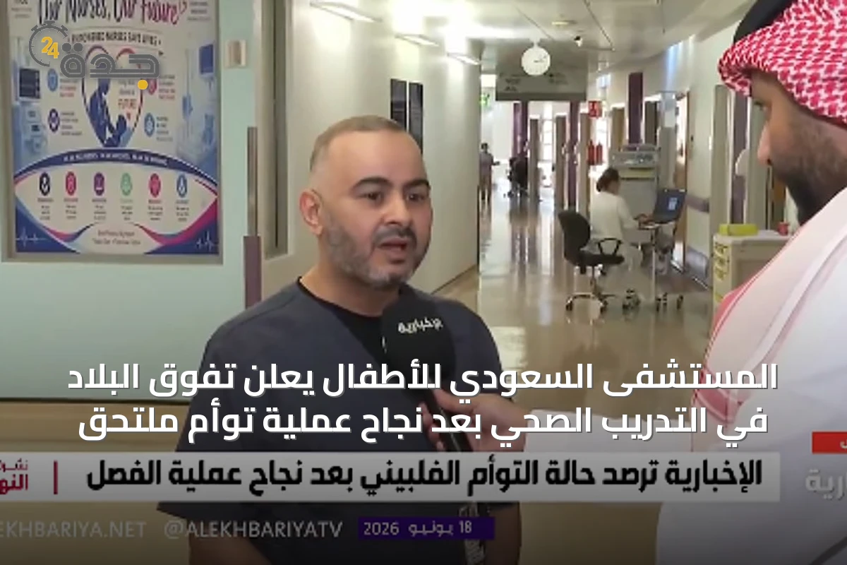 المستشفى السعودي للأطفال يعلن تفوق البلاد في التدريب الصحي بعد نجاح عملية توأم ملتحق