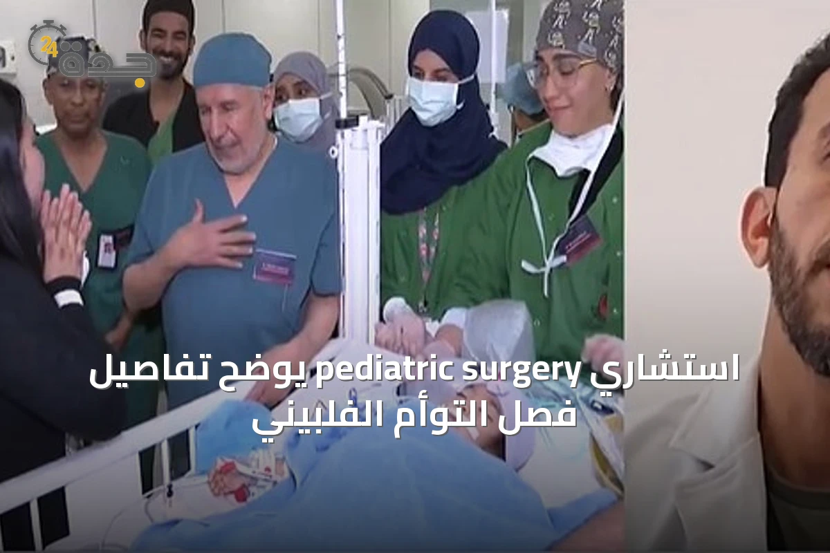استشاري pediatric surgery يوضح تفاصيل فصل التوأم الفلبيني