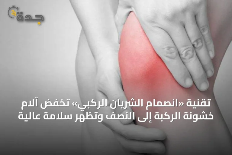 تقنية «انصمام الشريان الركبي» تخفض آلام خشونة الركبة إلى النصف وتُظهر سلامة عالية