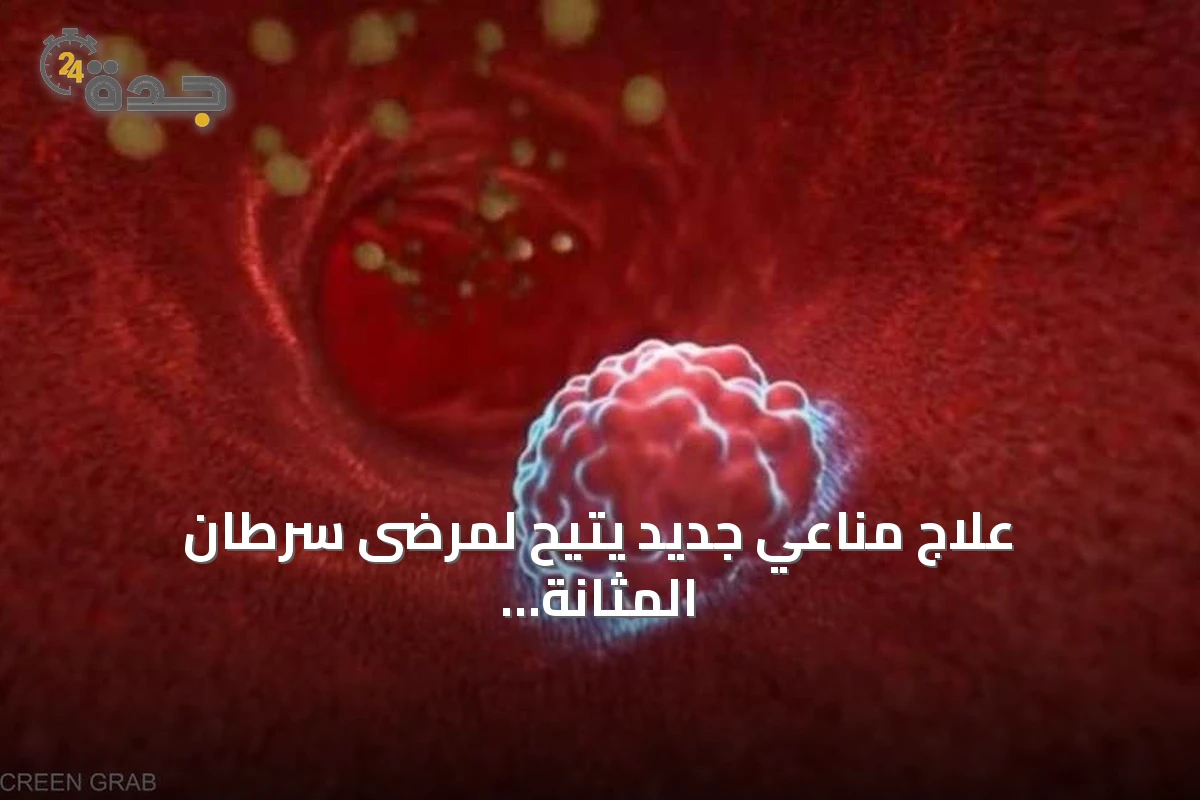 علاج مناعي جديد يتيح لمرضى سرطان المثانة تجنب الاستئصال الجراحي