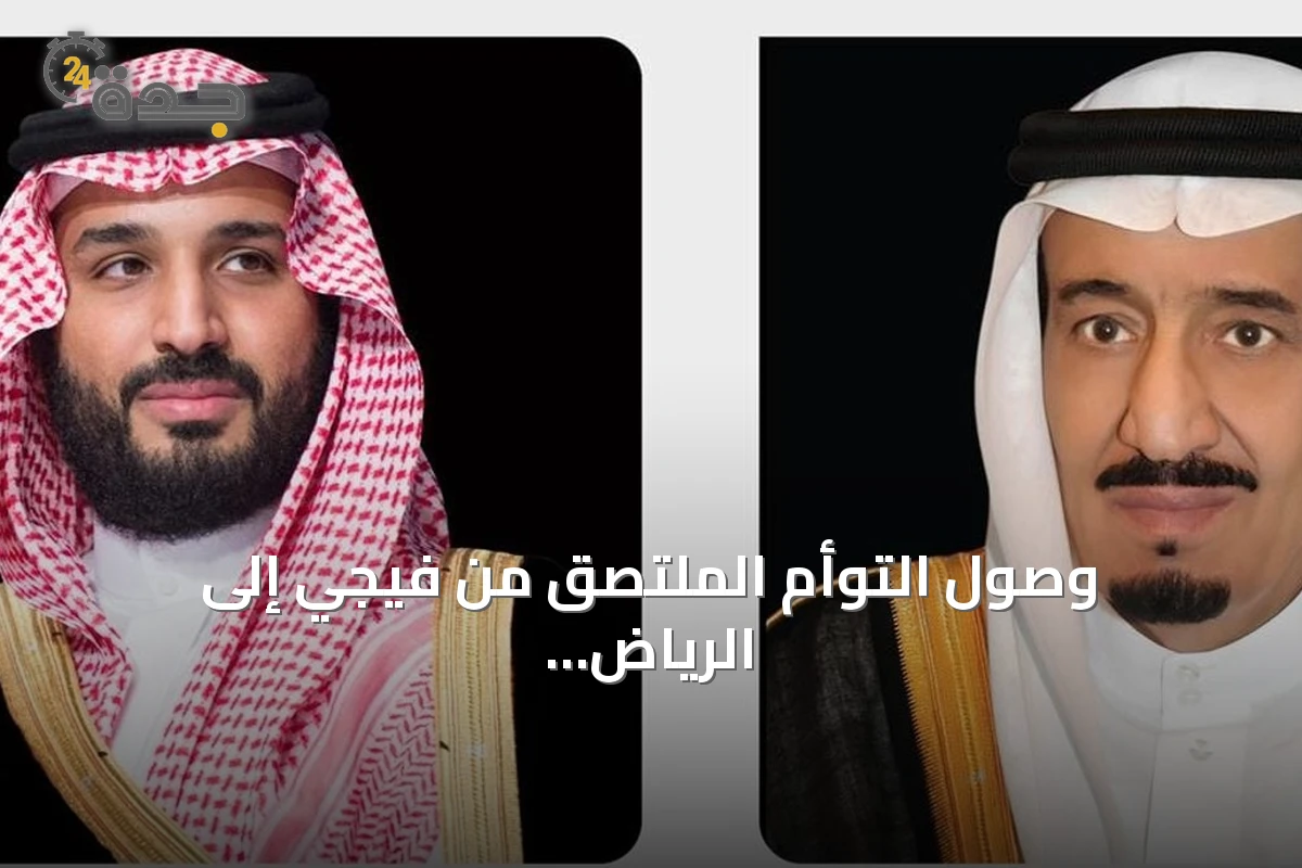 وصول التوأم الملتصق من فيجي إلى الرياض لدراسة إمكانية فصلهما