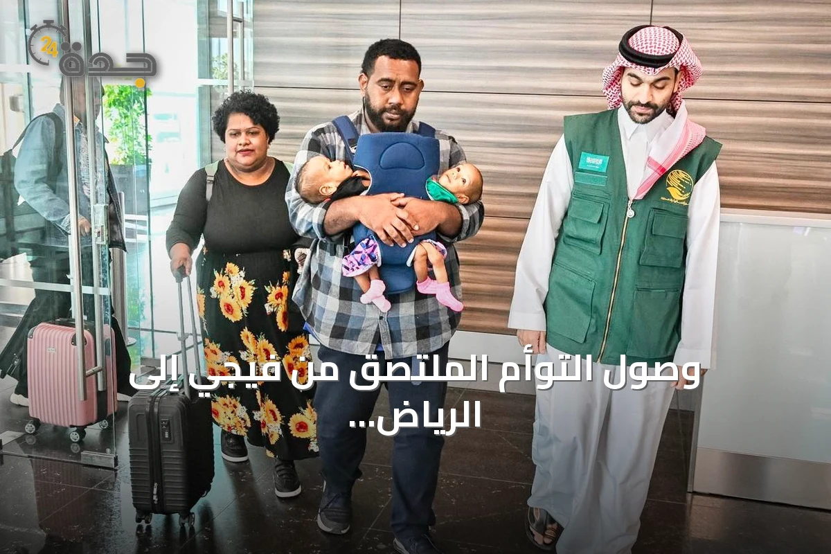 وصول التوأم الملتصق من فيجي إلى الرياض لدراسة حالتهما والنظر في إمكانية فصلهما