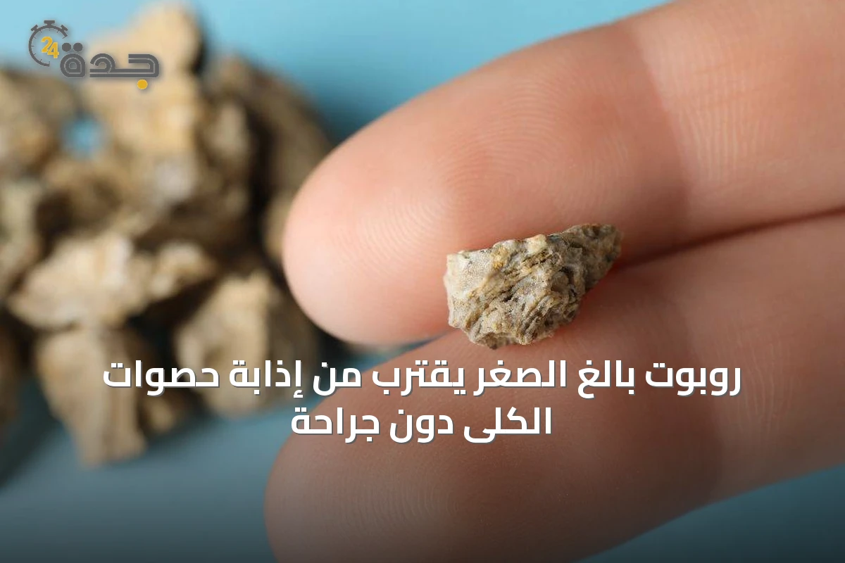 روبوت بالغ الصغر يقترب من إذابة حصوات الكلى دون جراحة