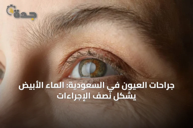 جراحات العيون في السعودية: الماء الأبيض يشكل نصف الإجراءات