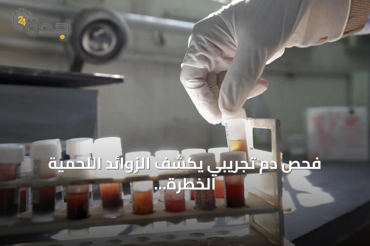 فحص دم تجريبي يكشف الزوائد اللحمية الخطرة قبل تحولها إلى سرطان القولون والمستقيم