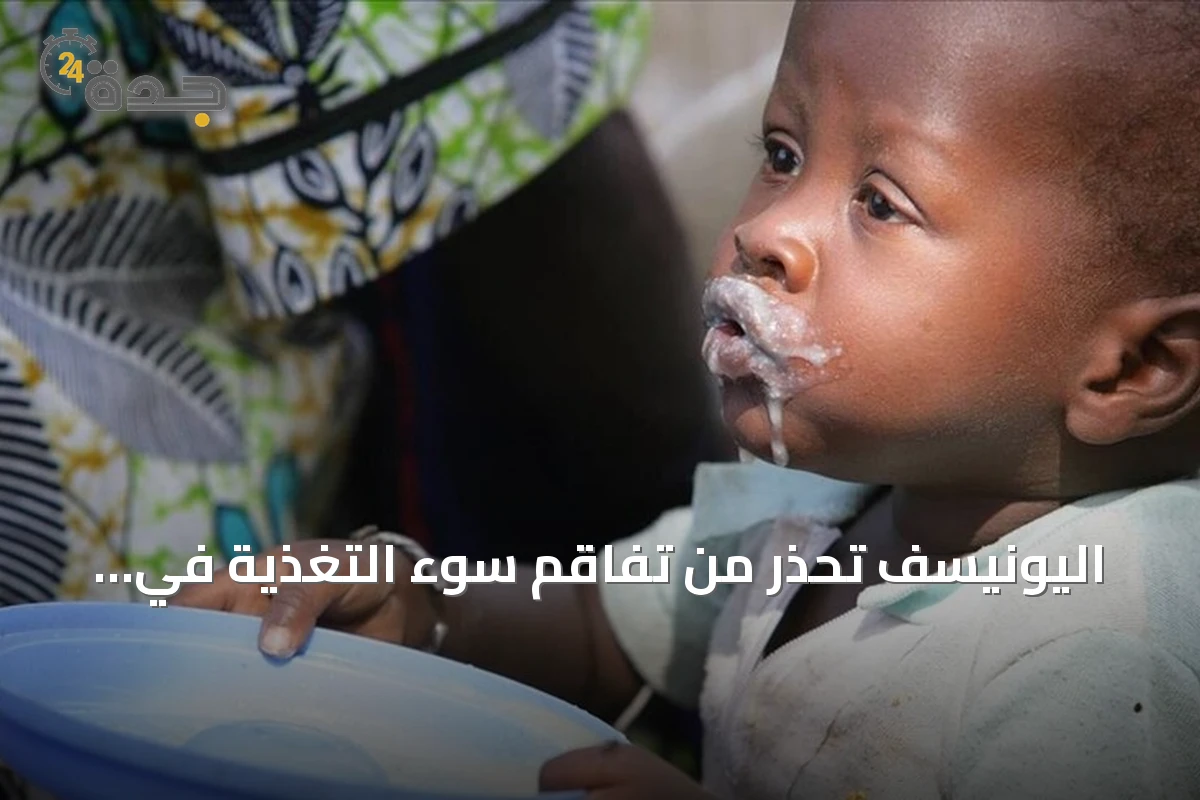 اليونيسف تحذر من تفاقم سوء التغذية في الصومال وتأثيره على 1.9 مليون طفل