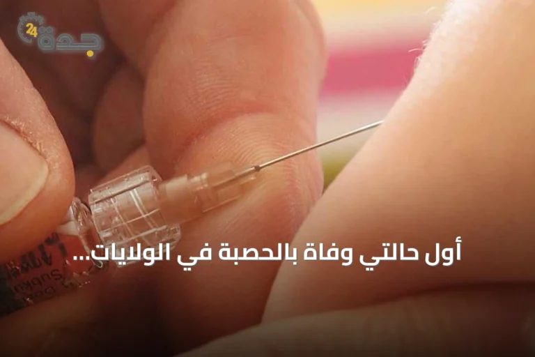 أول حالتي وفاة بالحصبة في الولايات المتحدة خلال 2026 تسجل في بنسلفانيا