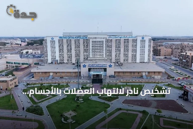 تشخيص نادر لالتهاب العضلات بالأجسام الاحتوائية بمستشفى الملك فهد المركزي بجازان