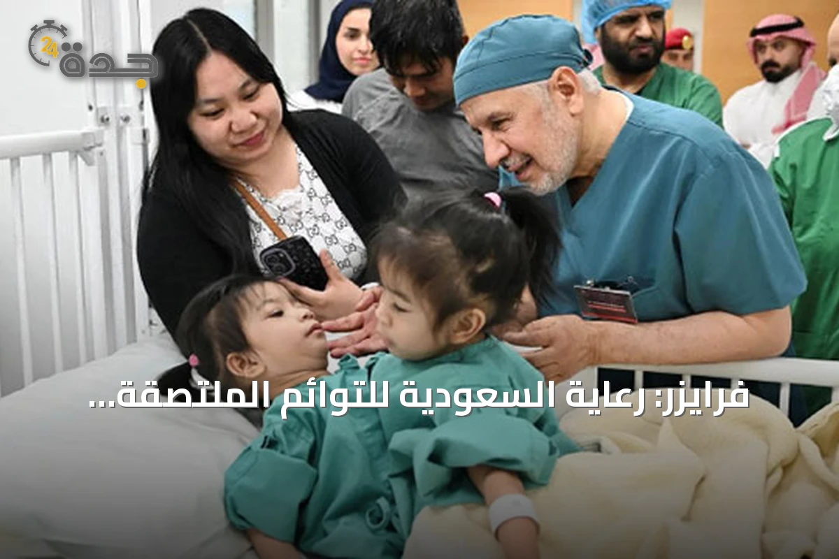 فرايزر: رعاية السعودية للتوائم الملتصقة نموذج دولي يُحتذى به