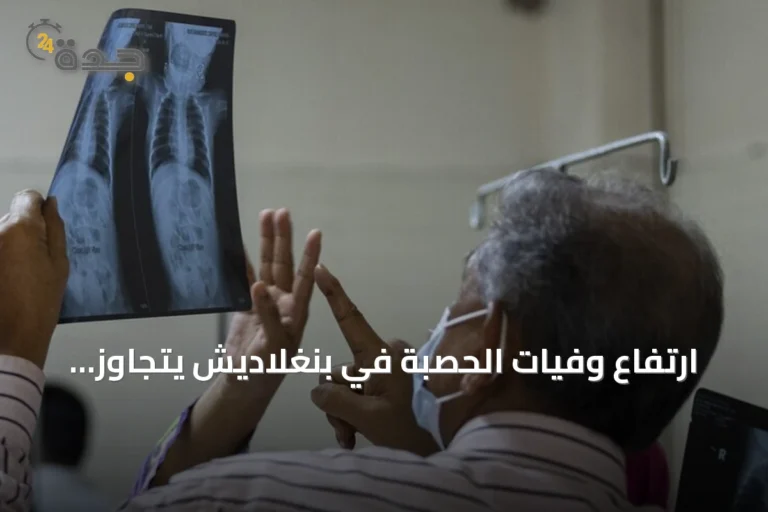 ارتفاع وفيات الحصبة في بنغلاديش يتجاوز ألف حالة