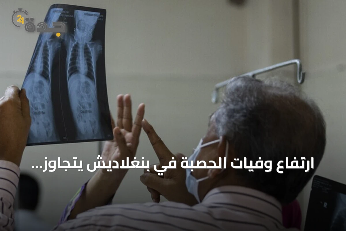 ارتفاع وفيات الحصبة في بنغلاديش يتجاوز ألف حالة