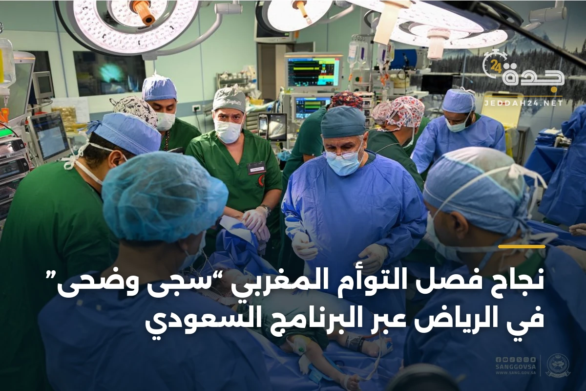 نجاح فصل التوأم المغربي “سجى وضحى” في الرياض عبر البرنامج السعودي 1 نجاح فصل التوأم المغربي “سجى وضحى” في الرياض عبر البرنامج السعودي