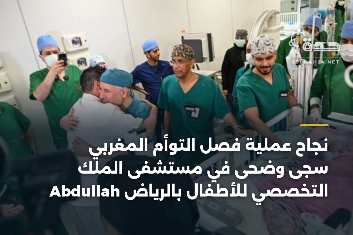 نجاح عملية فصل التوأم المغربي سجى وضحى في مستشفى الملك Abdullah التخصصي للأطفال بالرياض