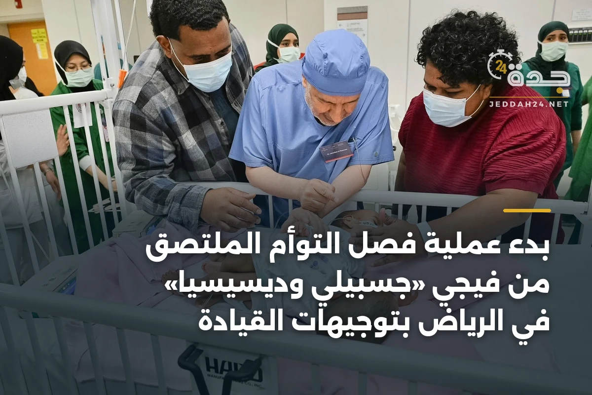 بدء عملية فصل التوأم الملتصق من فيجي «جسبيلي وديسيسيا» في الرياض بتوجيهات القيادة