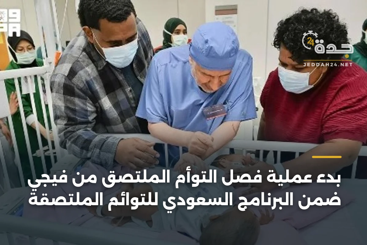 بدء عملية فصل التوأم الملتصق من فيجي ضمن البرنامج السعودي للتوائم الملتصقة