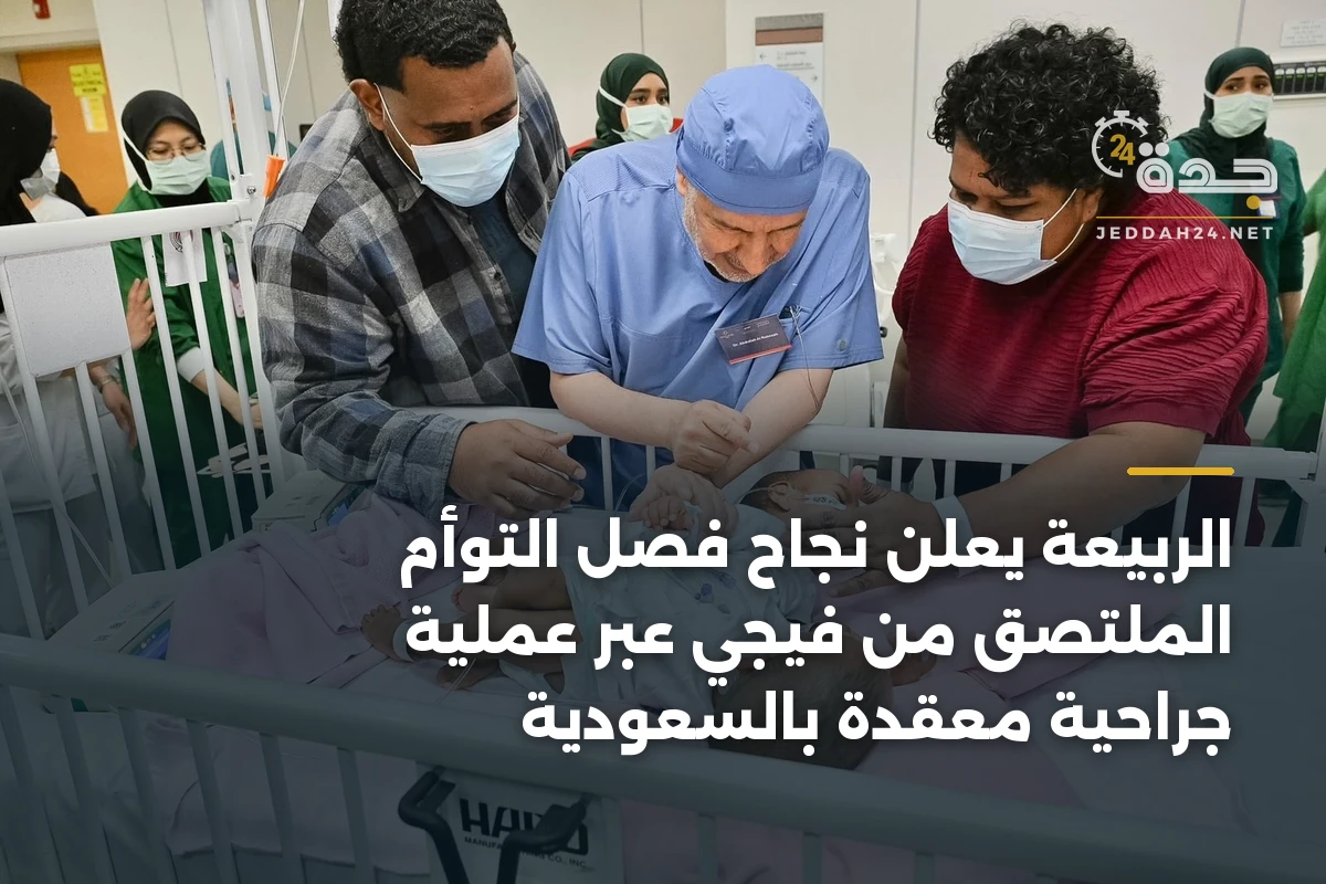 الربيعة يعلن نجاح فصل التوأم الملتصق من فيجي عبر عملية جراحية معقدة بالسعودية