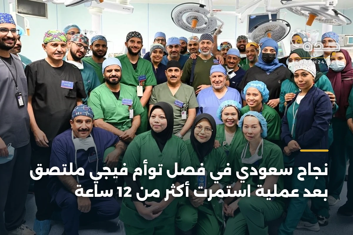 نجاح سعودي في فصل توأم فيجي ملتصق بعد عملية استمرت أكثر من 12 ساعة 1 نجاح سعودي في فصل توأم فيجي ملتصق بعد عملية استمرت أكثر من 12 ساعة