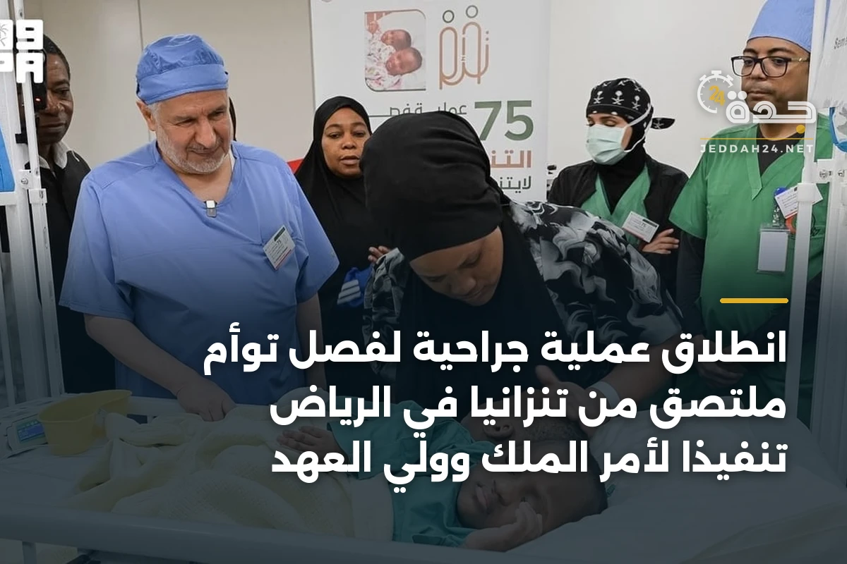 انطلاق عملية جراحية لفصل توأم ملتصق من تنزانيا في الرياض تنفيذاً لأمر الملك وولي العهد 1 انطلاق عملية جراحية لفصل توأم ملتصق من تنزانيا في الرياض تنفيذاً لأمر الملك وولي العهد