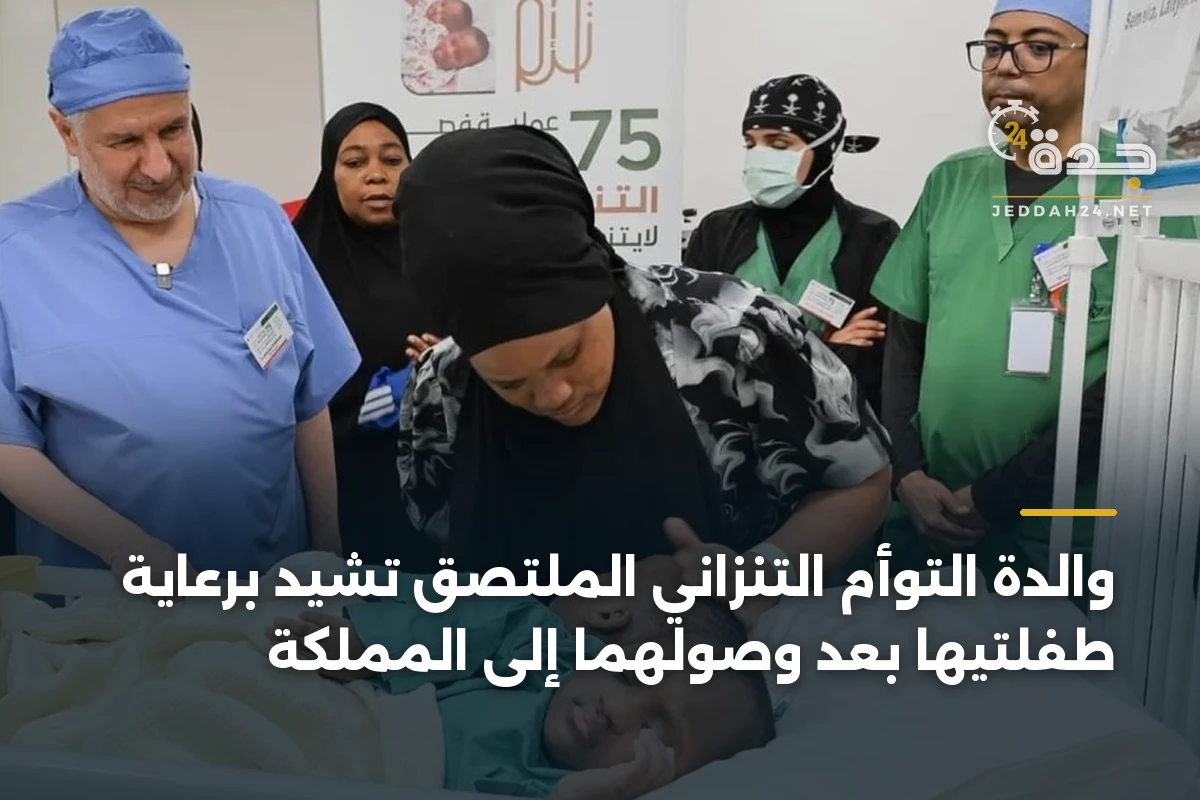 والدة التوأم التنزاني الملتصق تشيد برعاية طفلتيها بعد وصولهما إلى المملكة 1 والدة التوأم التنزاني الملتصق تشيد برعاية طفلتيها بعد وصولهما إلى المملكة